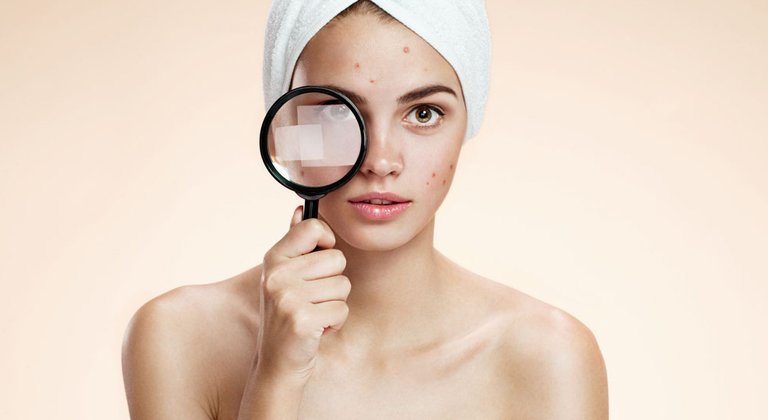 ragazza con lente d'ingrandimento e brufoli