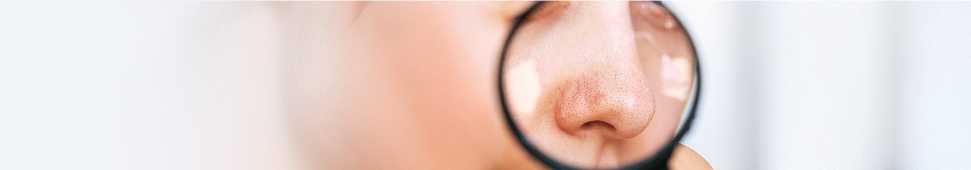 acido salicilico punti neri