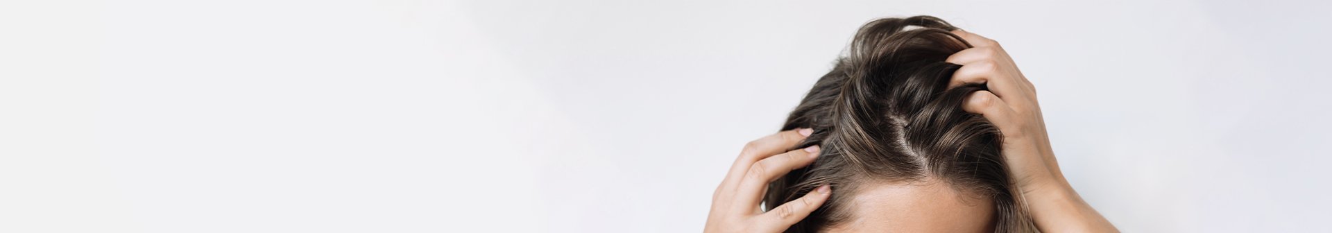 Cause e Rimedi Efficaci per i Capelli Unti ed Oleosi-1