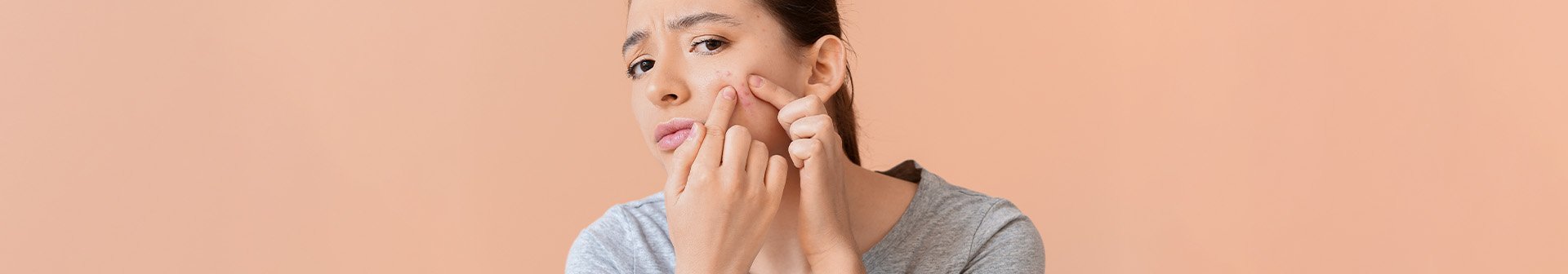 Niacinamide e Macchie da Brufoli: Effetti sulla Pelle