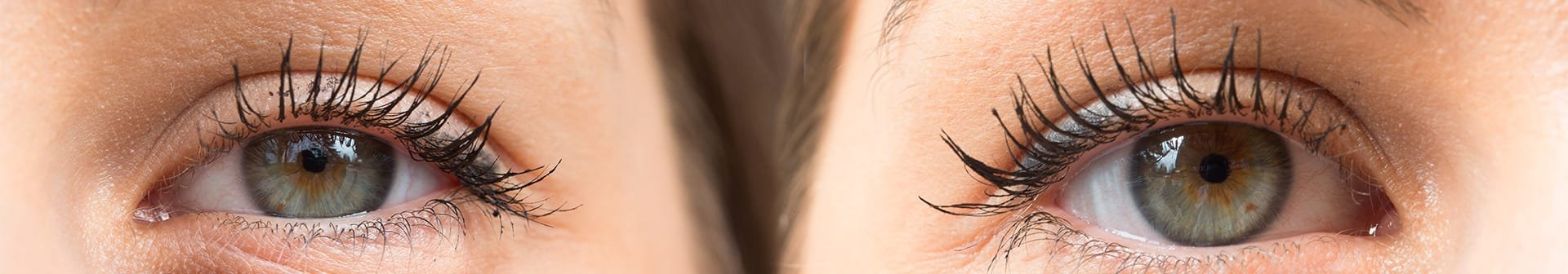 Cause e rimedi delle borse e occhiaie sotto gli occhi