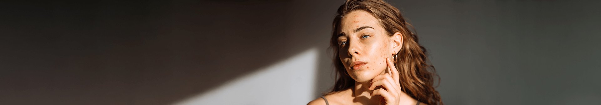 come coprire i brufoli