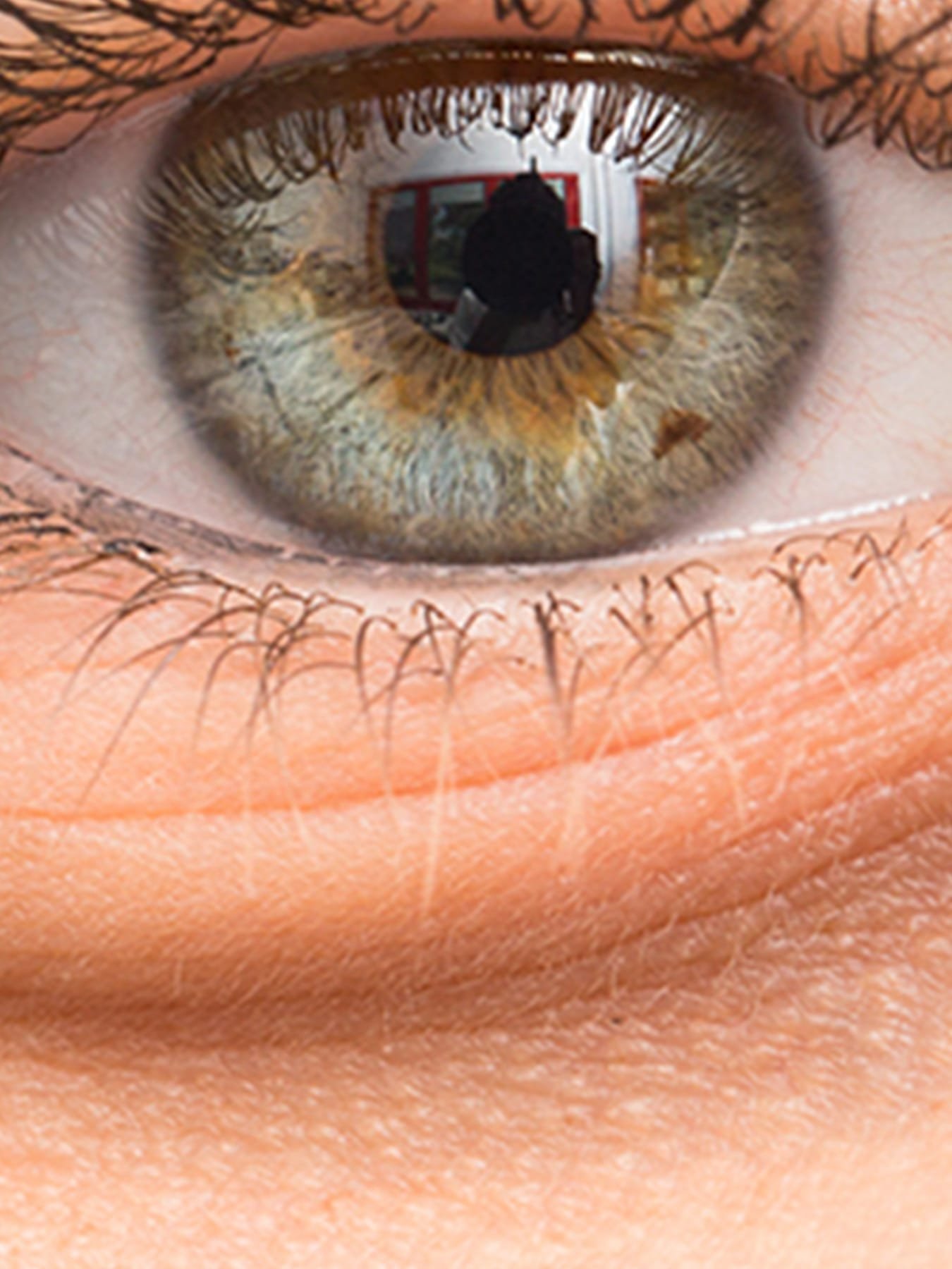 Come-e-Perch-Usare-la-Crema-Contorno-Occhi-per-le-Occhiaie_search