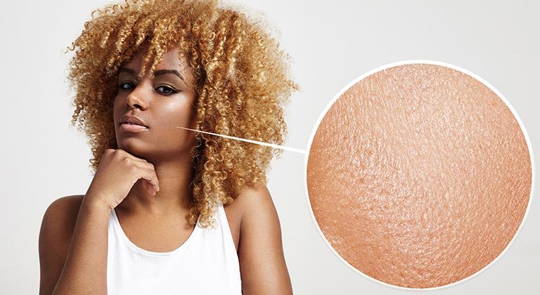 pelle viso ispessita rimedi