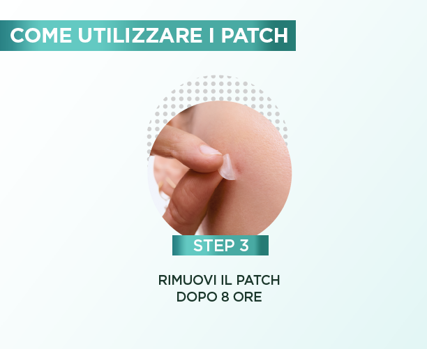 Azione e rimozione
